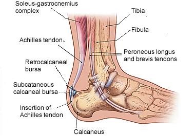 Blessure: Achillespees